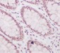 Anti-Histone H3 (acetyl K56) HIST1H3A Rabbit Monoclonal Antibody